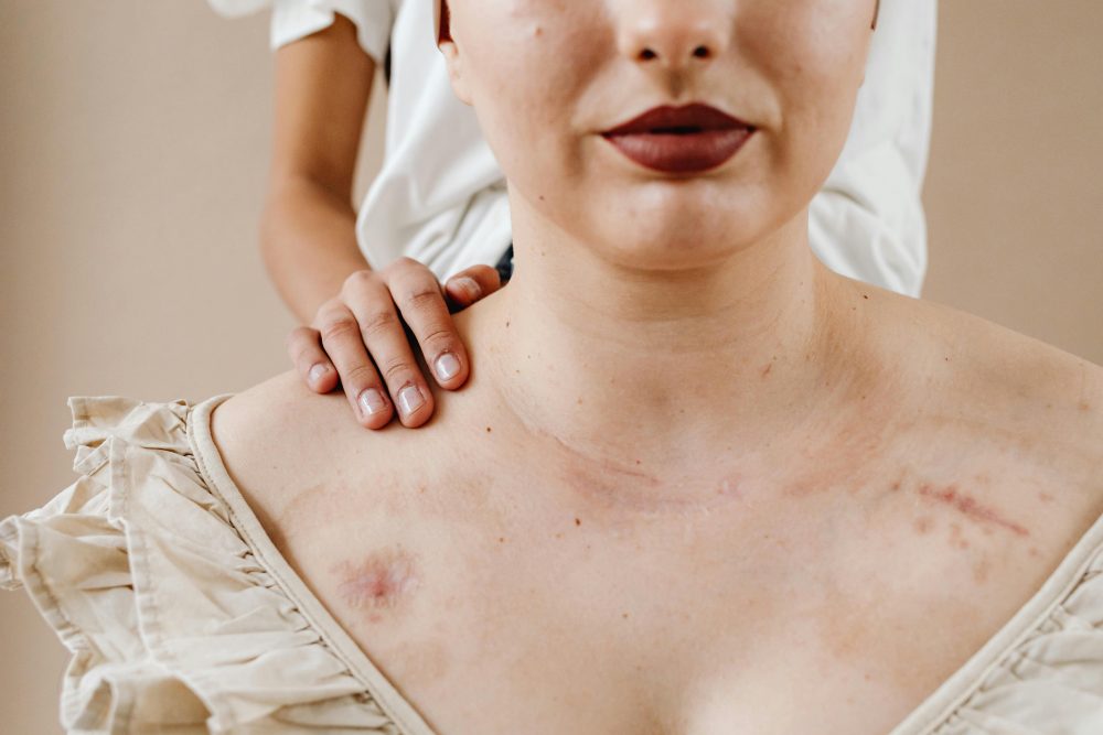 A comforting touch on a woman